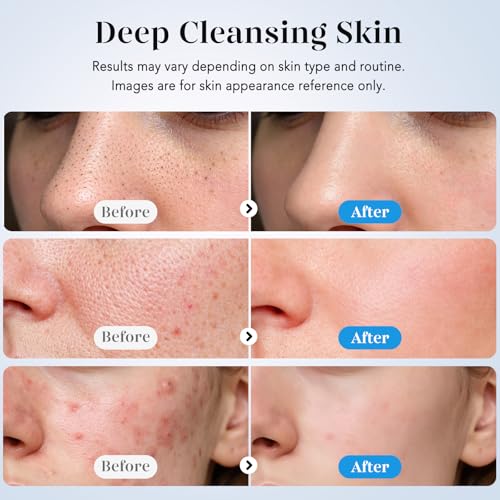 GUGUG Skin Scrubber Review